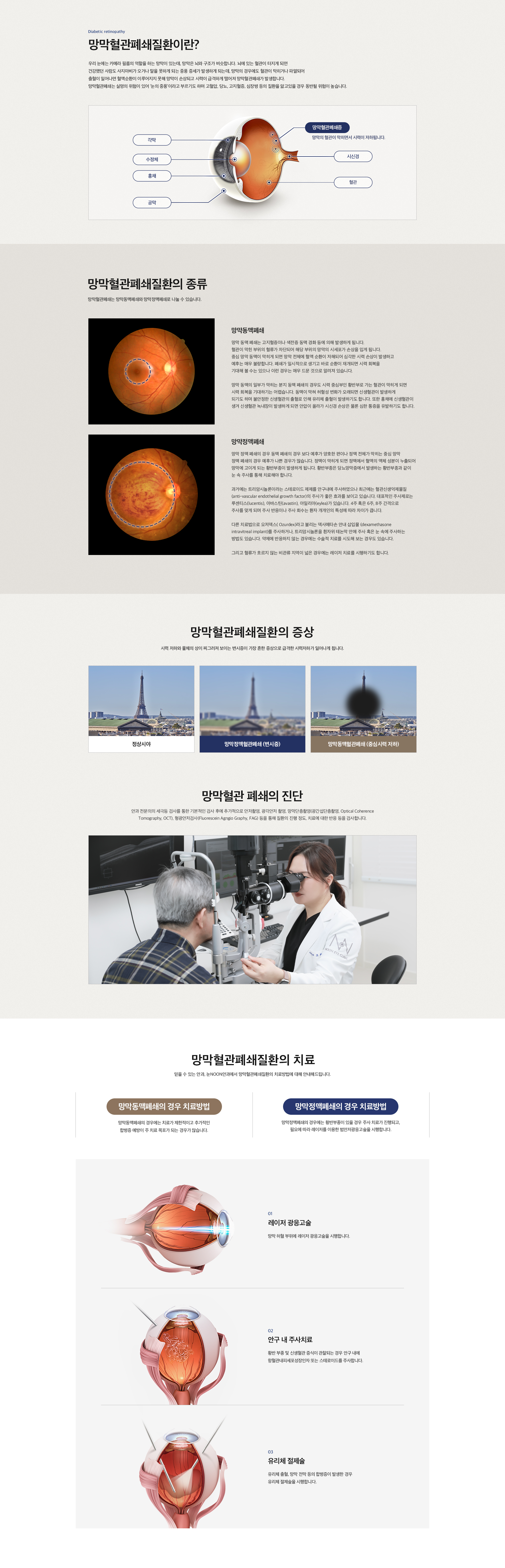망막혈관폐쇄질환