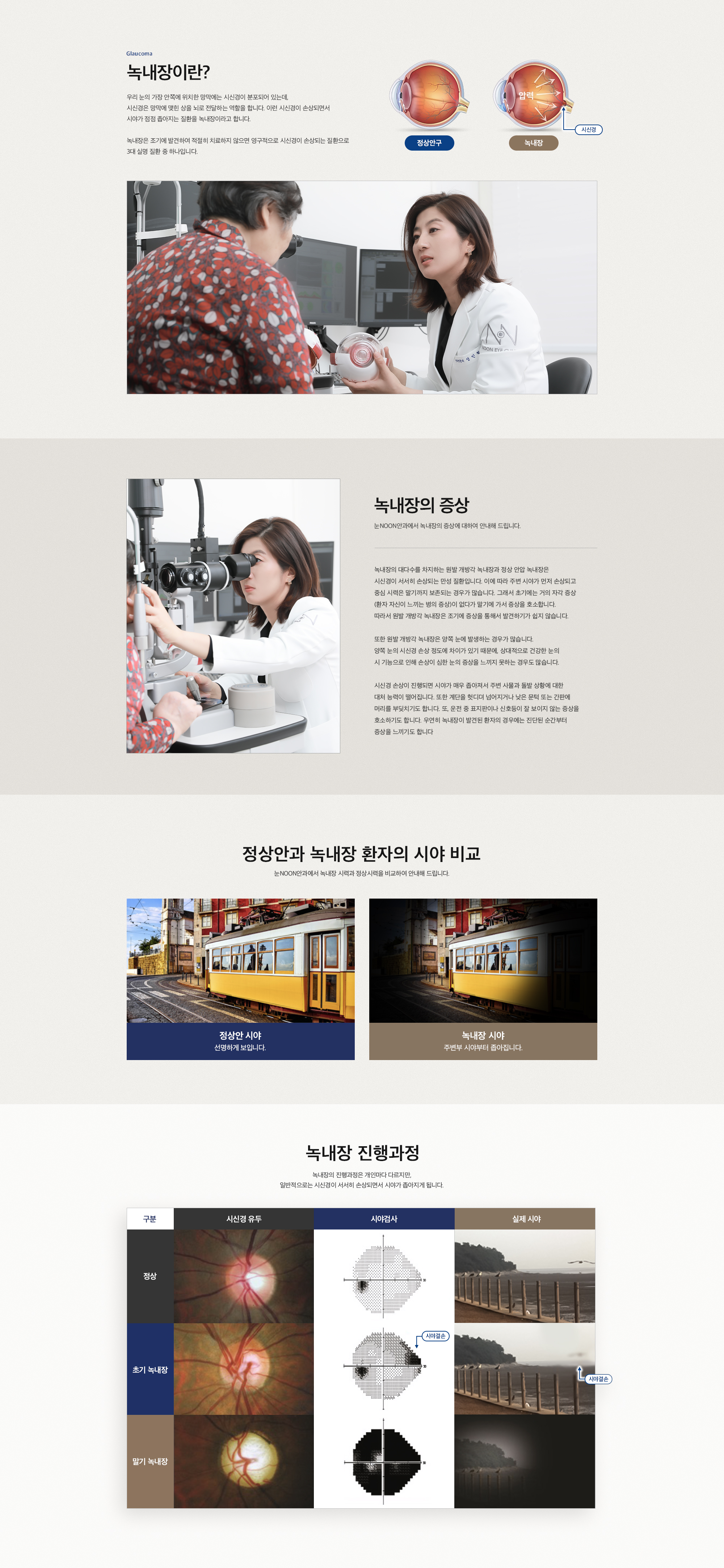 녹내장이란